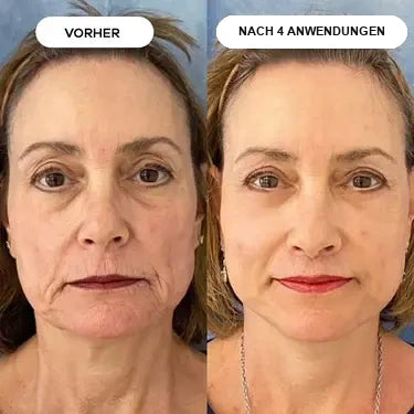 Stoppt Faltenbildung an der Ursache